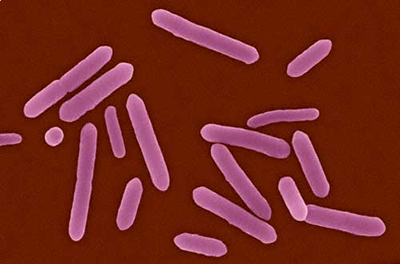 sewage Nanologix turns urine to electricity