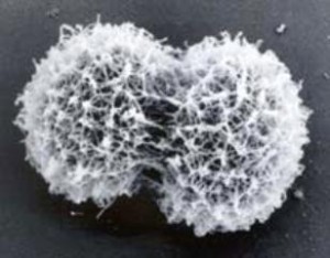 22828 microbe1 300x234 Coal Eating Microorganisms Could Boost Methane Gas Production